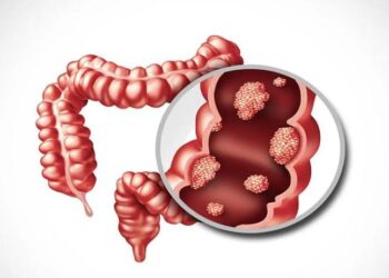 علماء كوريون يحولون خلايا سرطان القولون إلى خلايا طبيعية دون الحاجة إلى تدميرها