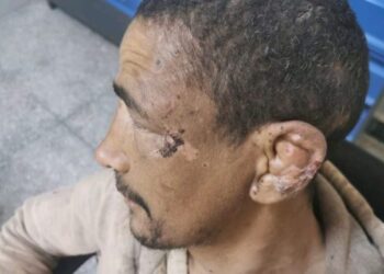 فضيحة مدوية: احتجاز شاب من تنغير في ضيعة فلاحية بمراكش لخمس سنوات