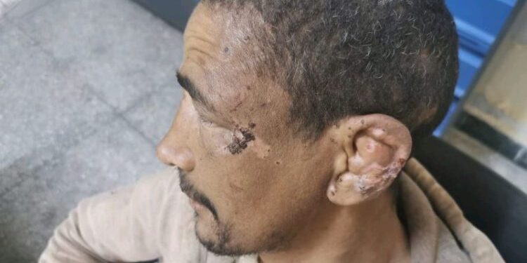 فضيحة مدوية: احتجاز شاب من تنغير في ضيعة فلاحية بمراكش لخمس سنوات