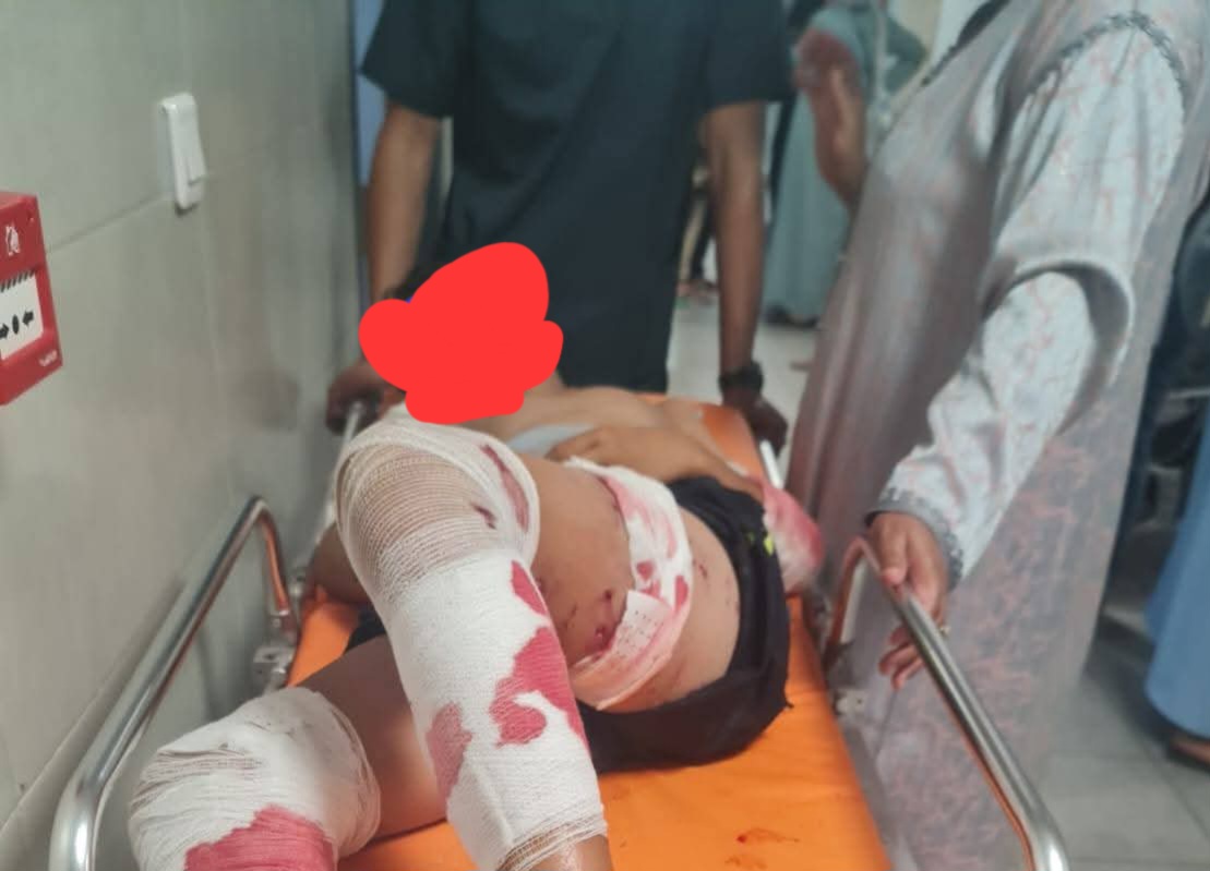 كلاب ضالة تهاجم طفلاً بشاطئ بولفضايل وتنقله في حالة حرجة للمستشفى