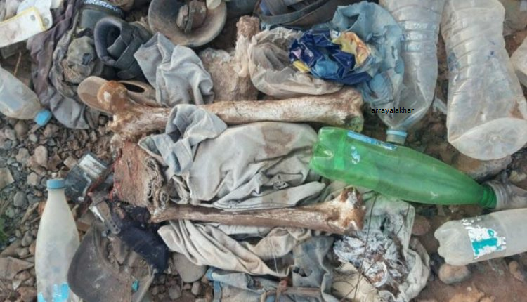 فضيحة بأكادير: طبيب يُلقي ببقايا بشرية في حاوية القمامة.