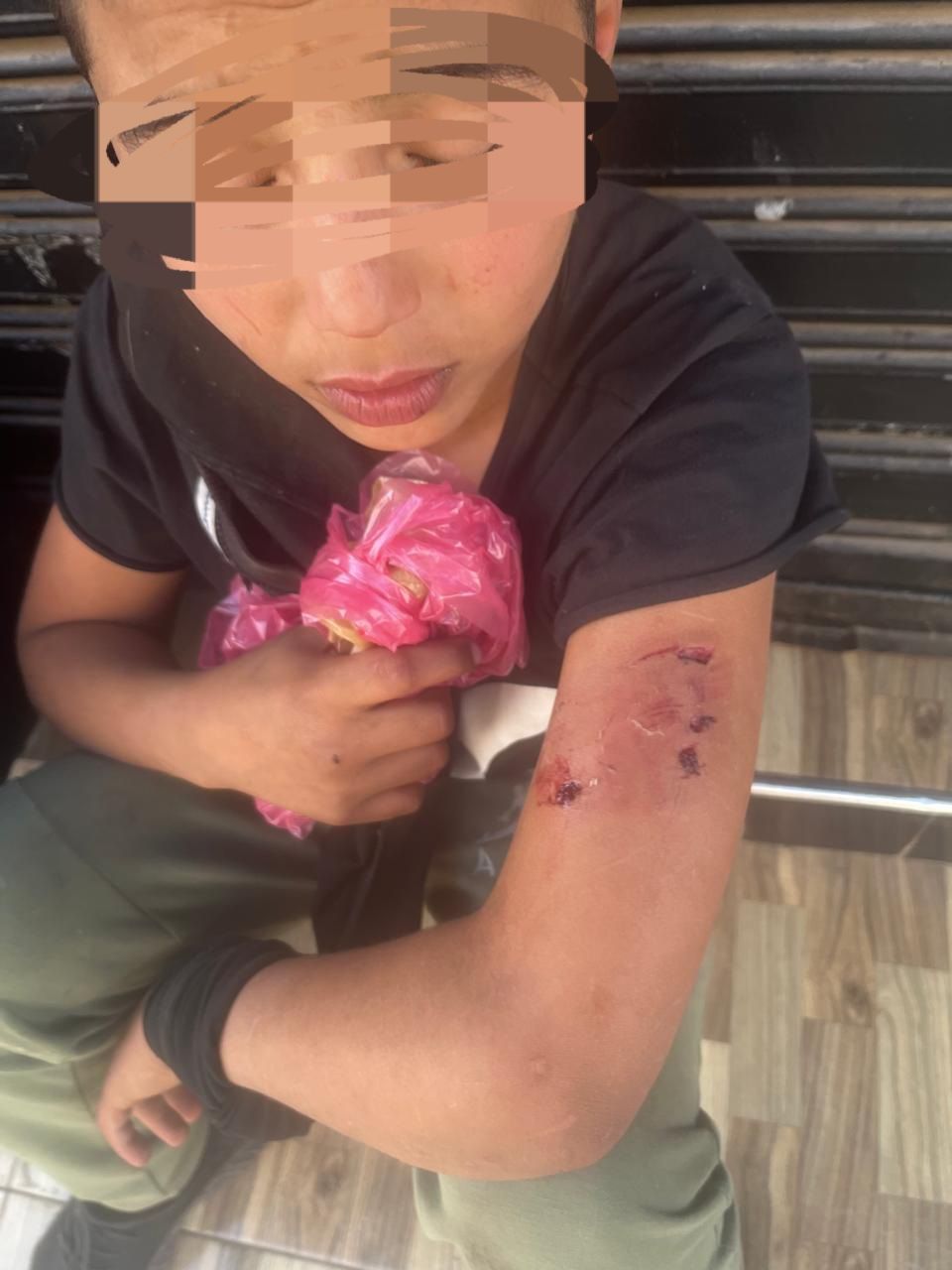 إصابة 14 شخصاً بعضات كلاب بجهة سوس ماسة تضع تدبير “الكلاب الضالة” تحت المجهر.