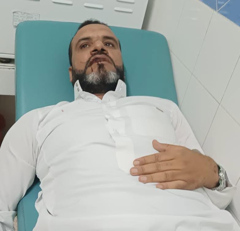 الدرك الملكي بسيدي بيبي يحقق في اعتداء جسدي طال الإعلامي حسن بركوز باشتوكة آيت باها